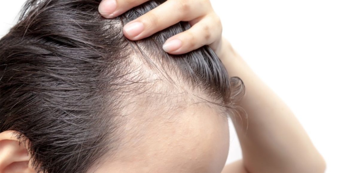 Dica para eles: veja como evitar a queda de cabelo precoce, especialista explica! ( foto: reprodução/canva )