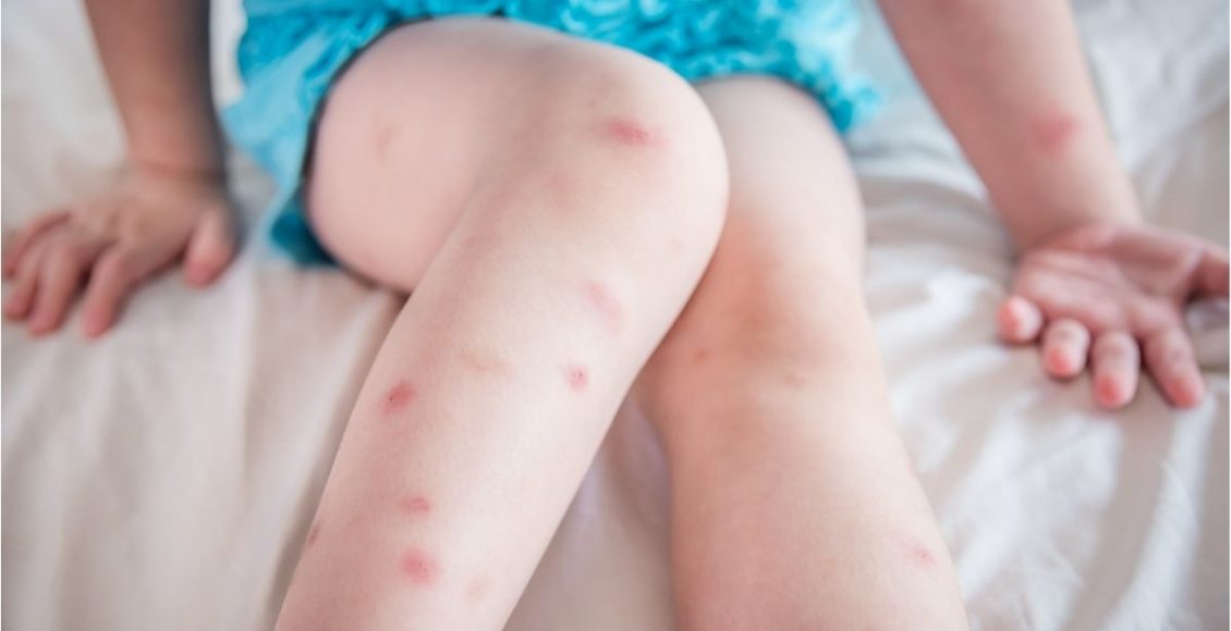 Receita de repelente natural para afastar os mosquitos de uma vez por todas - Reprodução Canva (2)