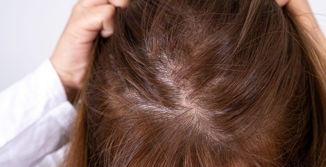 Cabelo fino: aprenda agora mesmo 4 dicas de como acabar com esse problema - Reprodução Canva