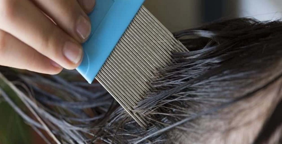 Adeus piolhos! Receita milagrosa ajuda a remover praga com menos de R$ 2 (e com ingredientes que tem em casa) - Fonte: Pixabay