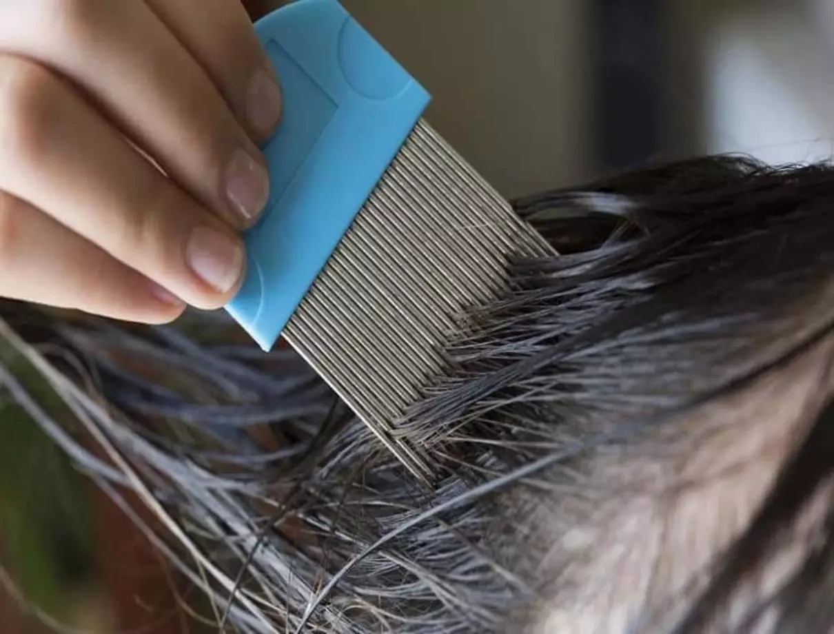 Adeus piolhos! Receita milagrosa ajuda a remover praga com menos de R$ 2 (e com ingredientes que tem em casa)