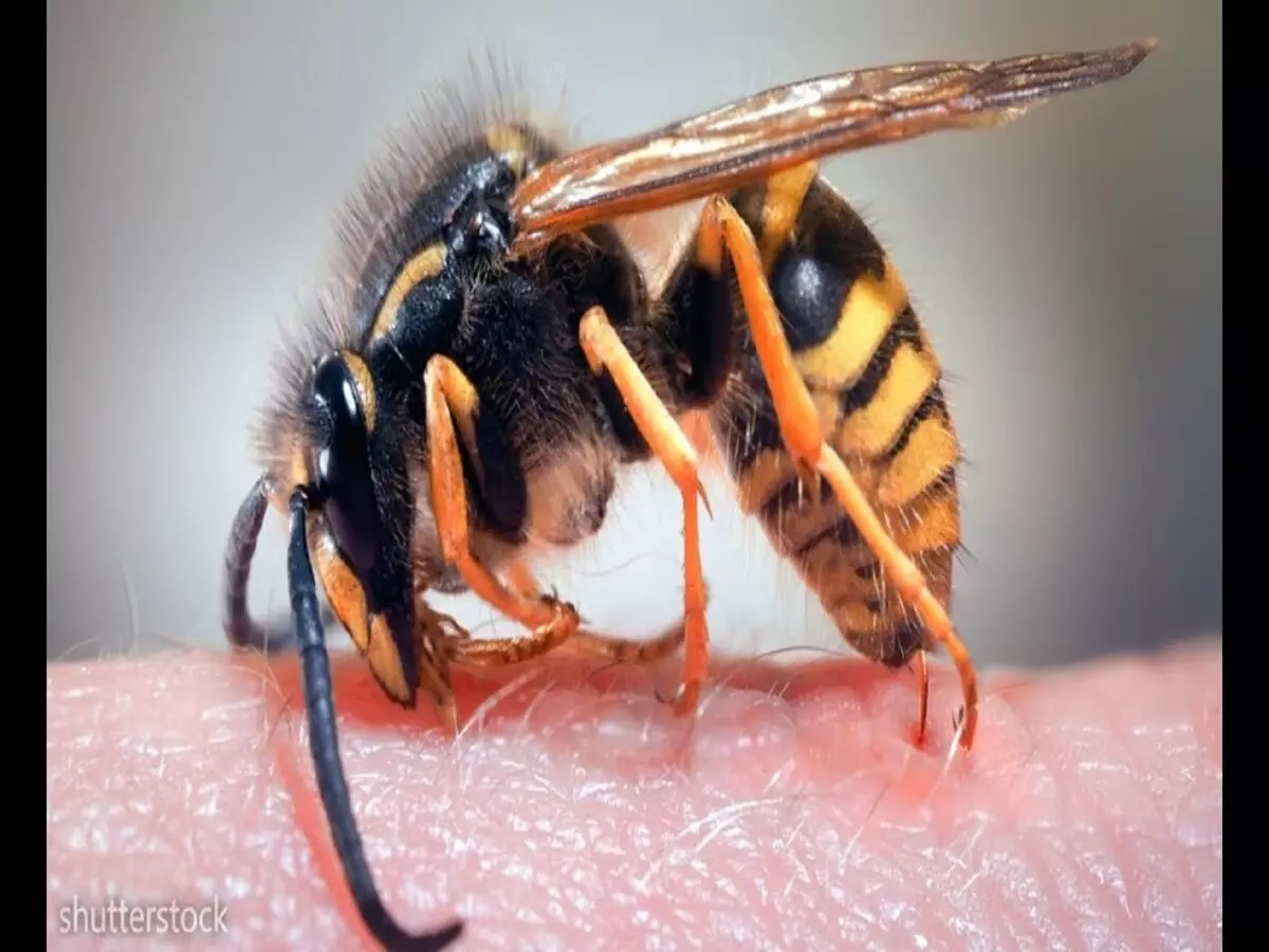 Foi picado por abelha ou vespa? Saiba agora o que fazer para proteger sua pele