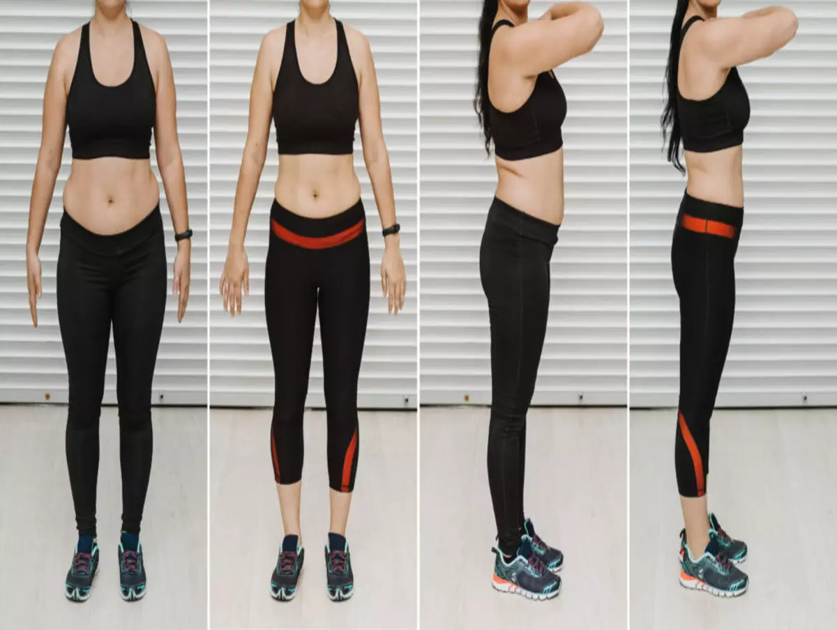 Nutricionista revela como queimar gordura abdominal sem fazer exercícios físicos - Fonte: Pixabay