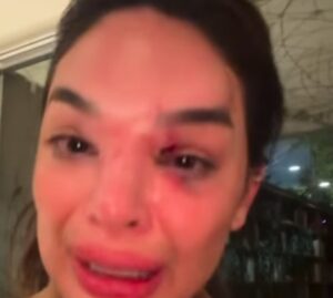 Giullia Kos foi ignorada por segurança durante agressão. Imagem: Reprodução