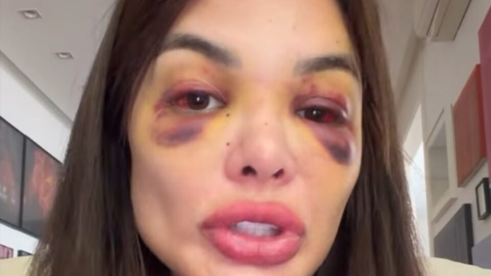 Giúllia Kos desabafa: ‘o meu único pedido é por Justiça’. Imagem: reprodução Instagram