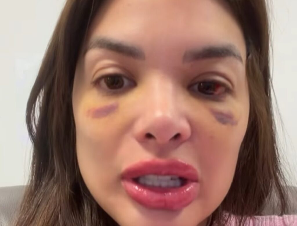 Giullia Kos: ‘Minha voz encorajou mulheres’. Imagem: Reprodução