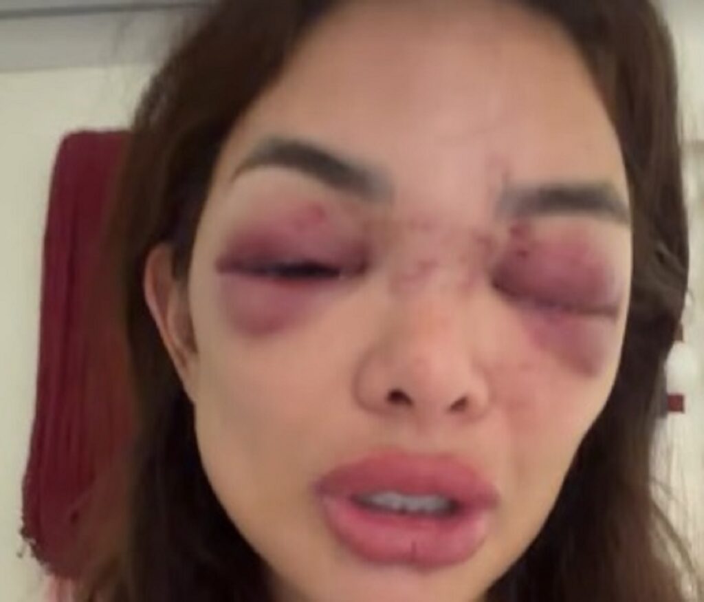 ‘É só a ponta do iceberg’, diz Giullia Kos sobre agressões. Imagem: Reprodução