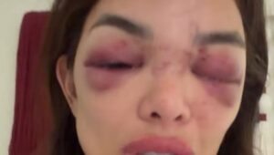 ‘É só a ponta do iceberg’, diz Giullia Kos sobre agressões. Imagem: Reprodução