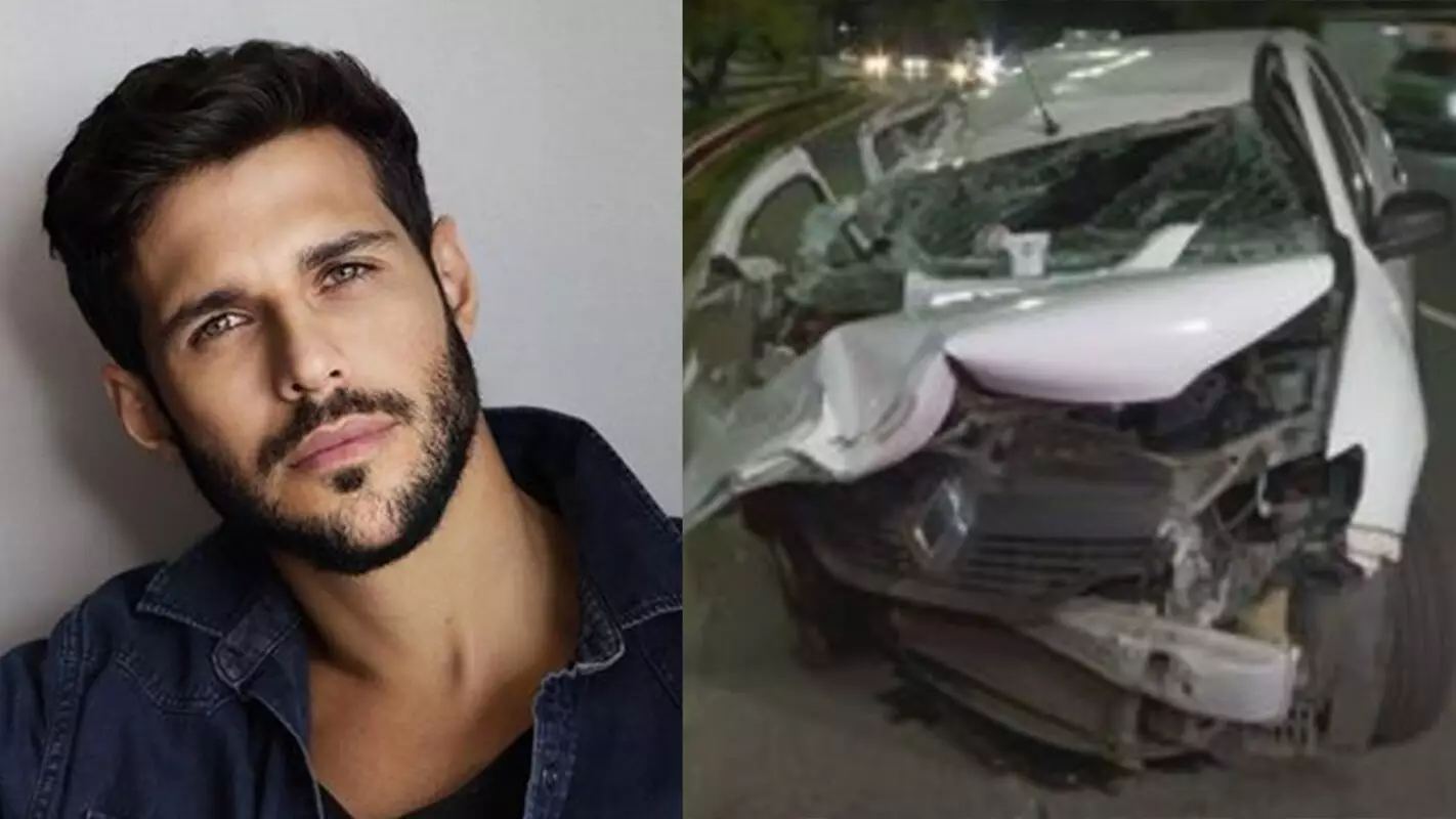 Rodrigo Mussi, após acidente, decide se mostrar pela primeira vez para público